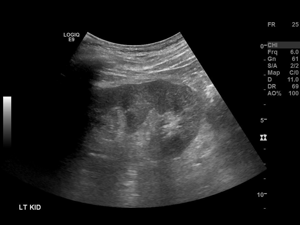 The same ultrasound image after Pixel Safe: the banner that carried the patient's details is blank, and the scan itself is unchanged.