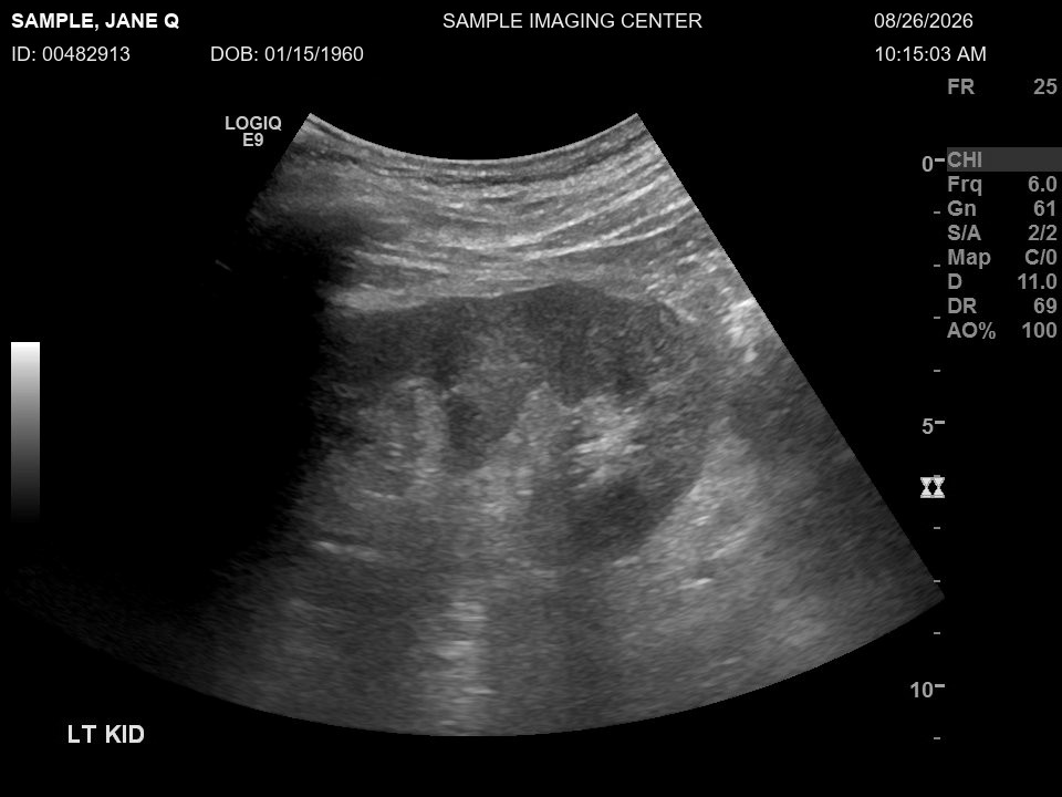 An ultrasound image of a kidney with a made-up patient's name, ID, date of birth and exam date in the scanner's banner across the top.